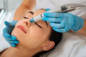 belle-skin-studio-Microneedling